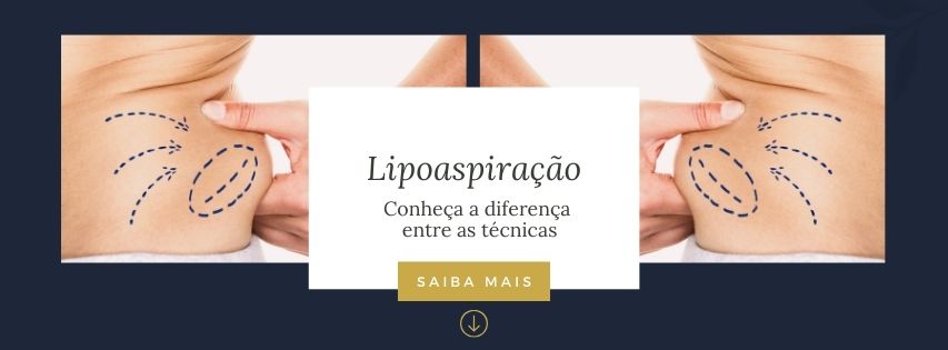 lipoaspiração