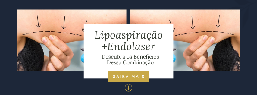 lipoaspiração com endolaser