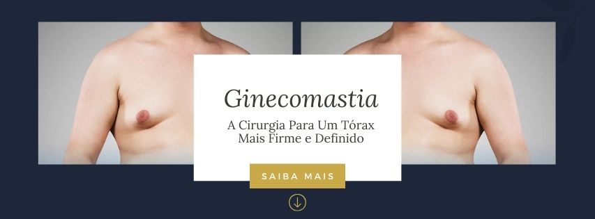 ginecomastia