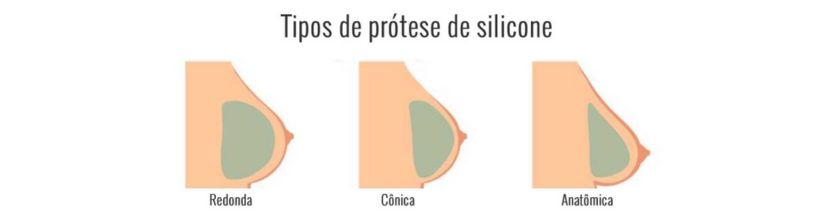 protese de mama